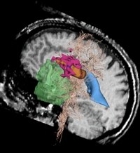 Can fMRI Tell If You're Lying? 