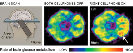 Different Brain Activity with and without cell phones activated